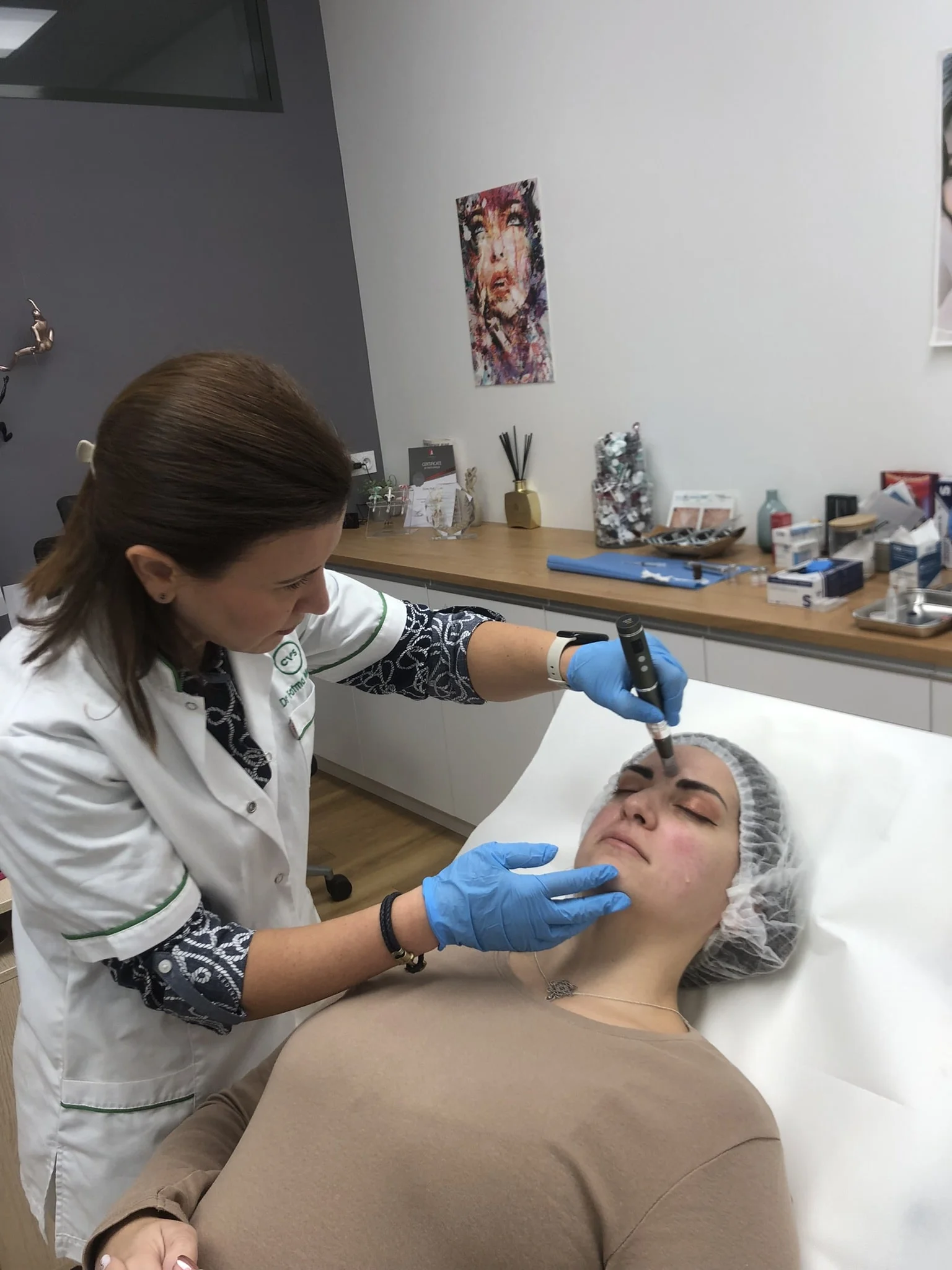 Microneedling Grenoble et Voiron